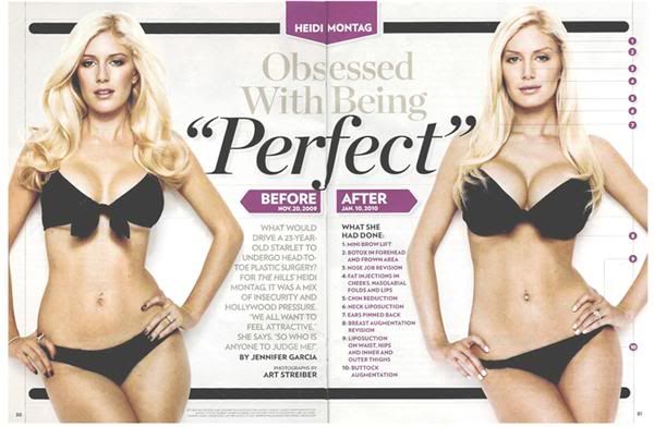 heidi montag before and after all. in done going An interview withchanged for their Doesnt regretsee latest photos efore in photos efore butjan Heidi+montag+efore+after+surgery